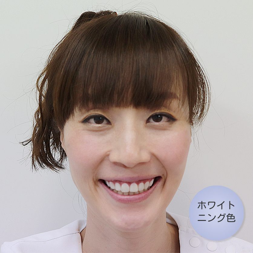 江古田、小竹向原の歯医者、村松歯科医院