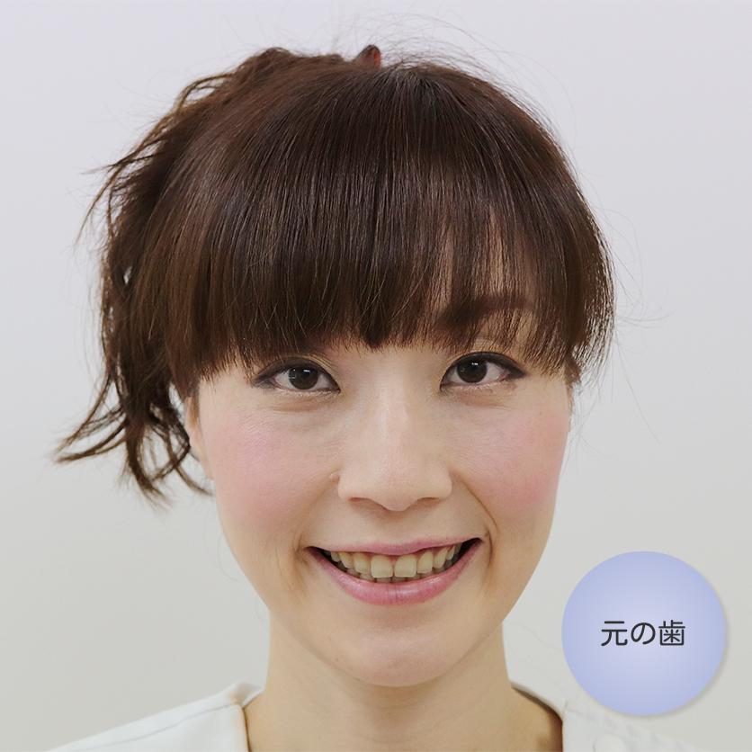江古田、小竹向原の歯医者、村松歯科医院